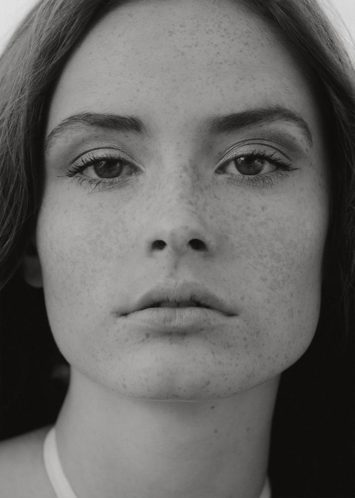 Ein Porträt einer Frau mit Sommersprossen, die direkt in die Kamera blickt.